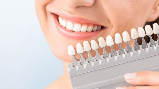 Metody wybielania zębów