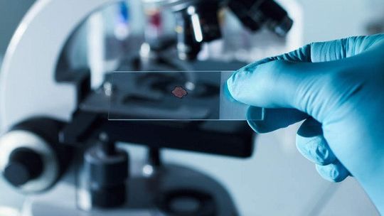 Nie pozwól się zaskoczyć nowotworom 