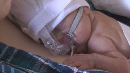 Oddział Noworodków i Wcześniaków